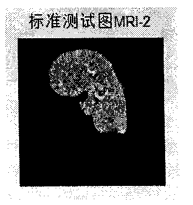 Watermarking method for medical images on basis of DFT (discrete Fourier transform) and LogisticMap