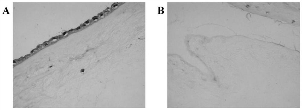 Preparation method of decellularized amnion intrauterine scaffold carrying estradiol microspheres