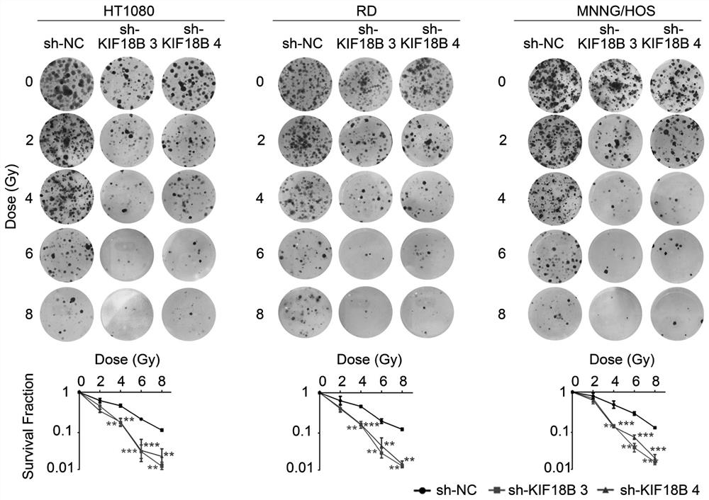 Sarcoma radiotherapy resistance-related diagnostic marker and application