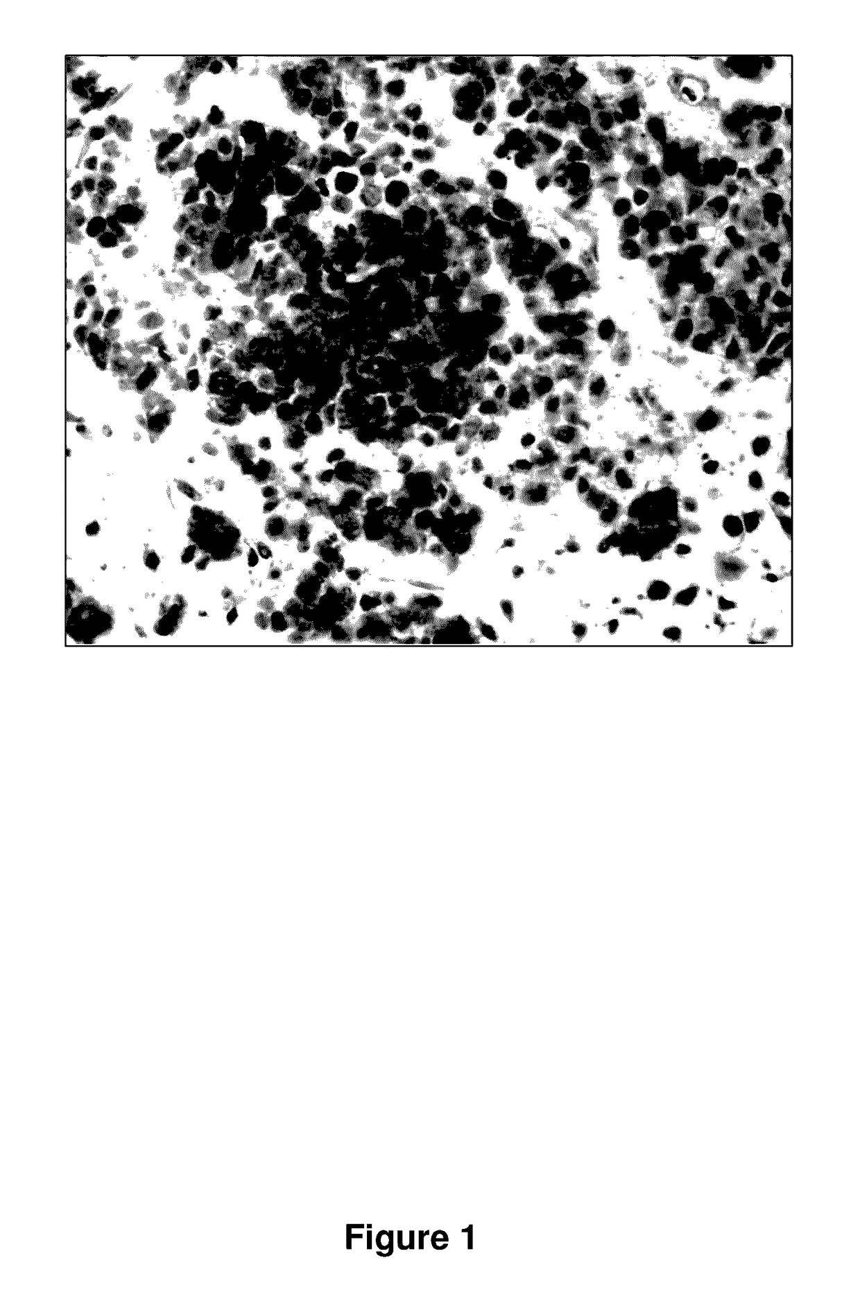 Antagonists for abdominal vasopressin v2 receptor and uses thereof