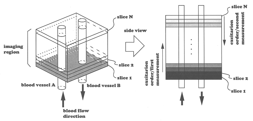 Magnetic resonance imaging apparatus