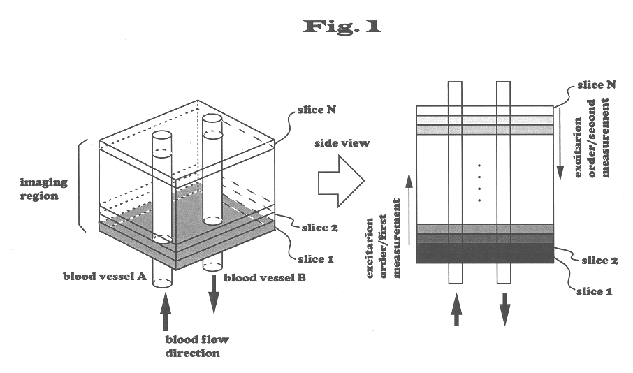 Magnetic resonance imaging apparatus