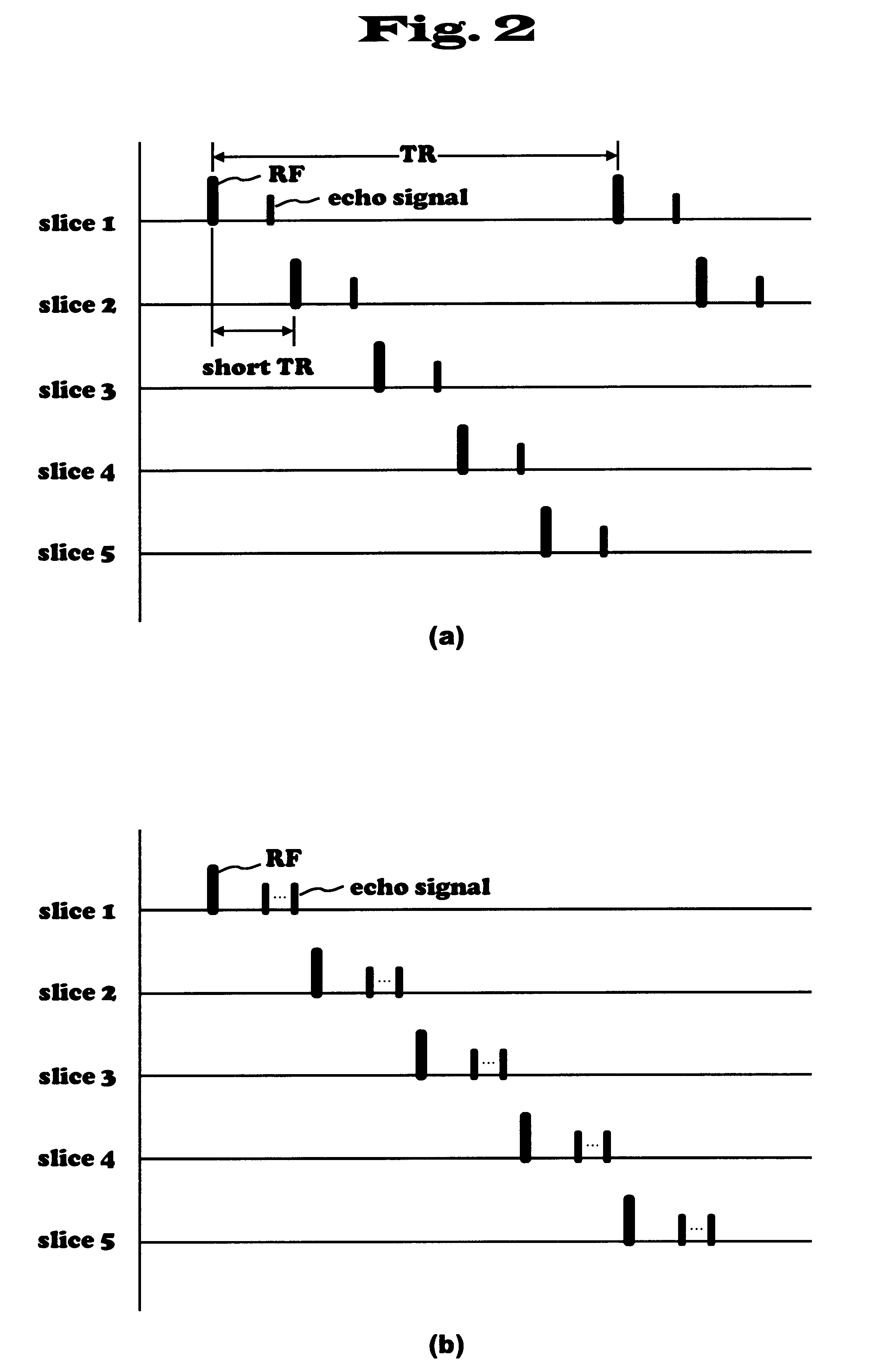 Magnetic resonance imaging apparatus