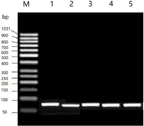 Quick amplification detection kit of SNP (single nucleotide polymorphism) site of MTRR (5-methyltetrahydrofolate-homocysteinemethyltransferase reductase) and detection method