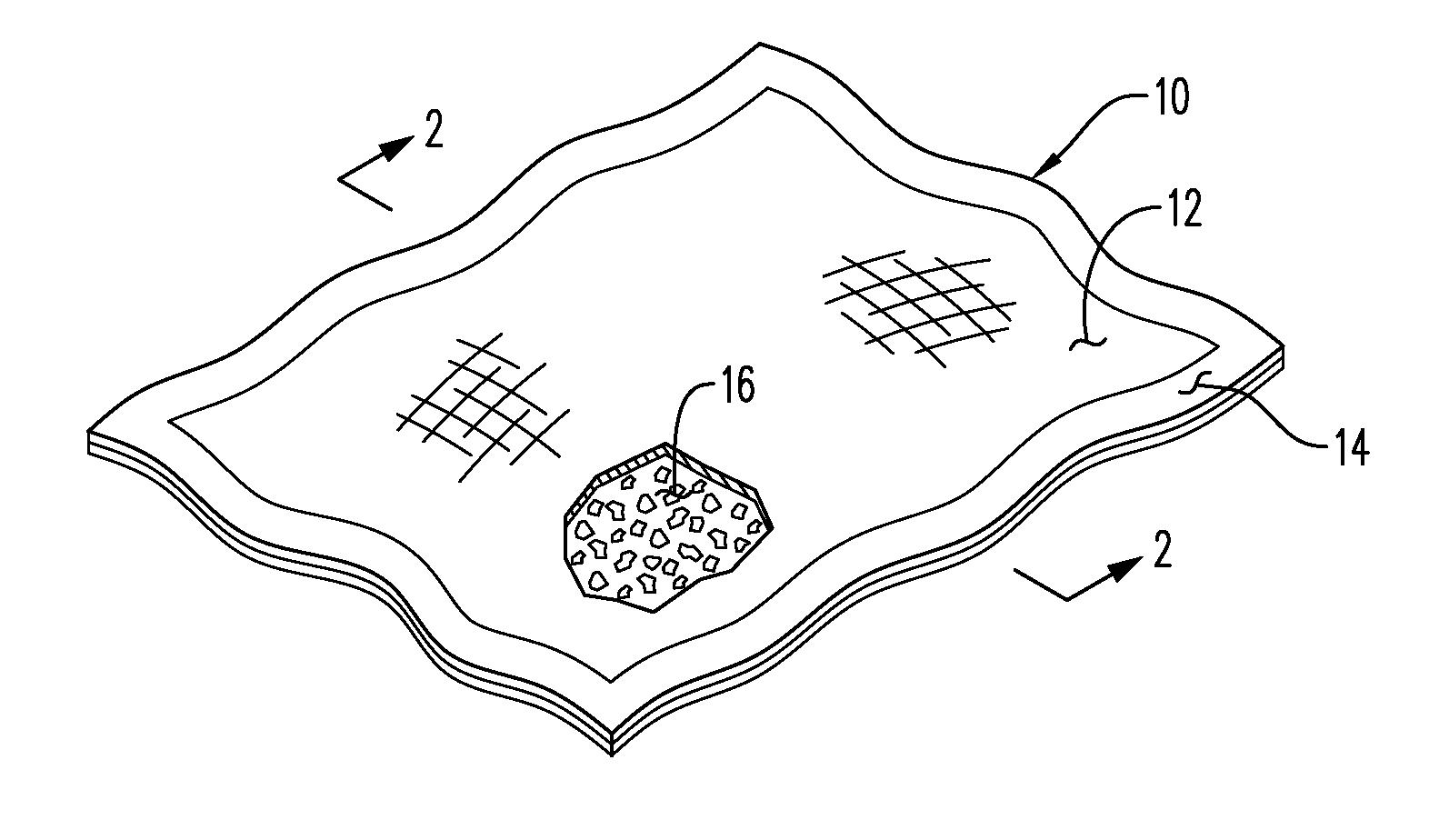 Hemostatic Wound Dressings