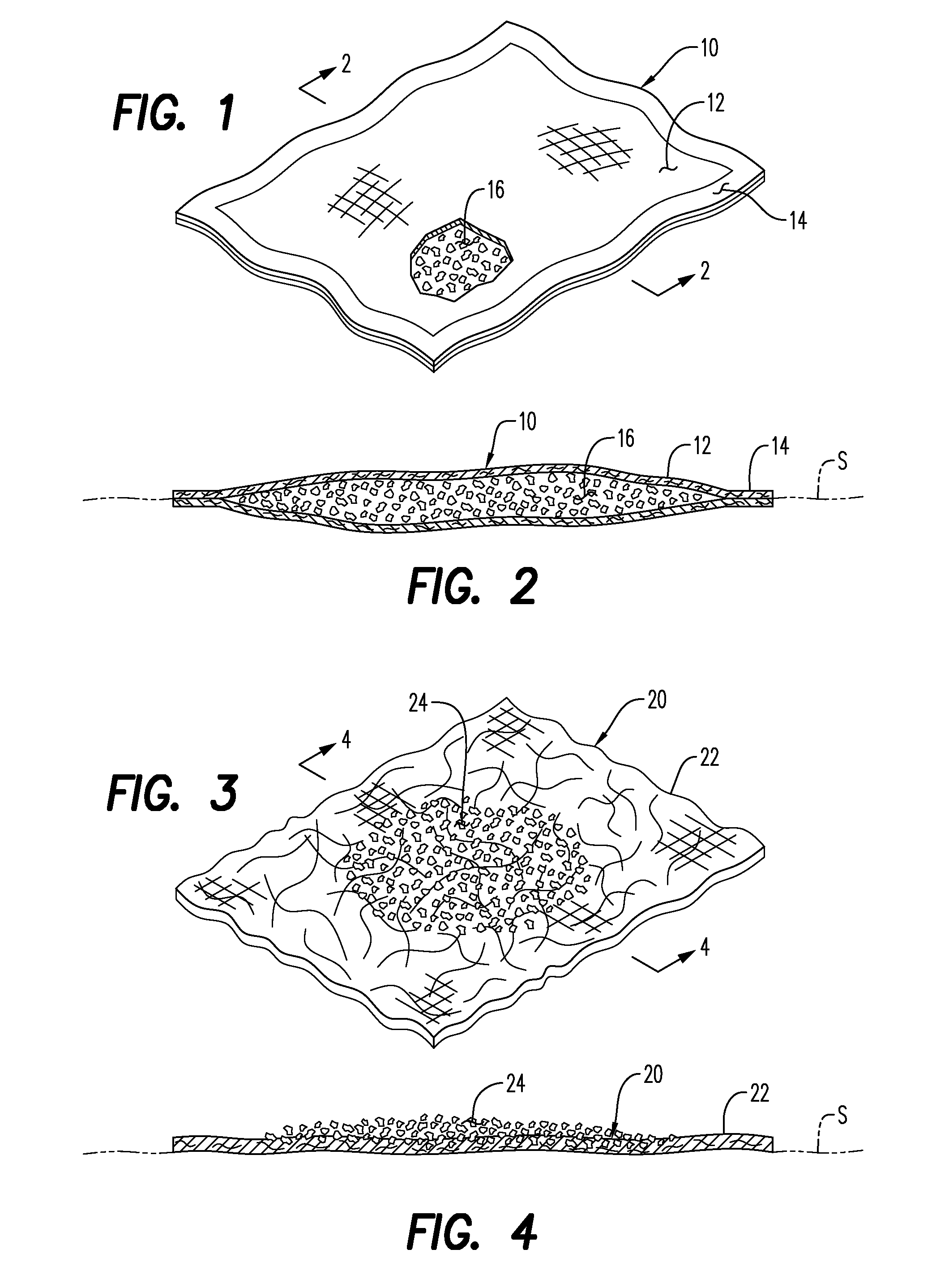 Hemostatic Wound Dressings