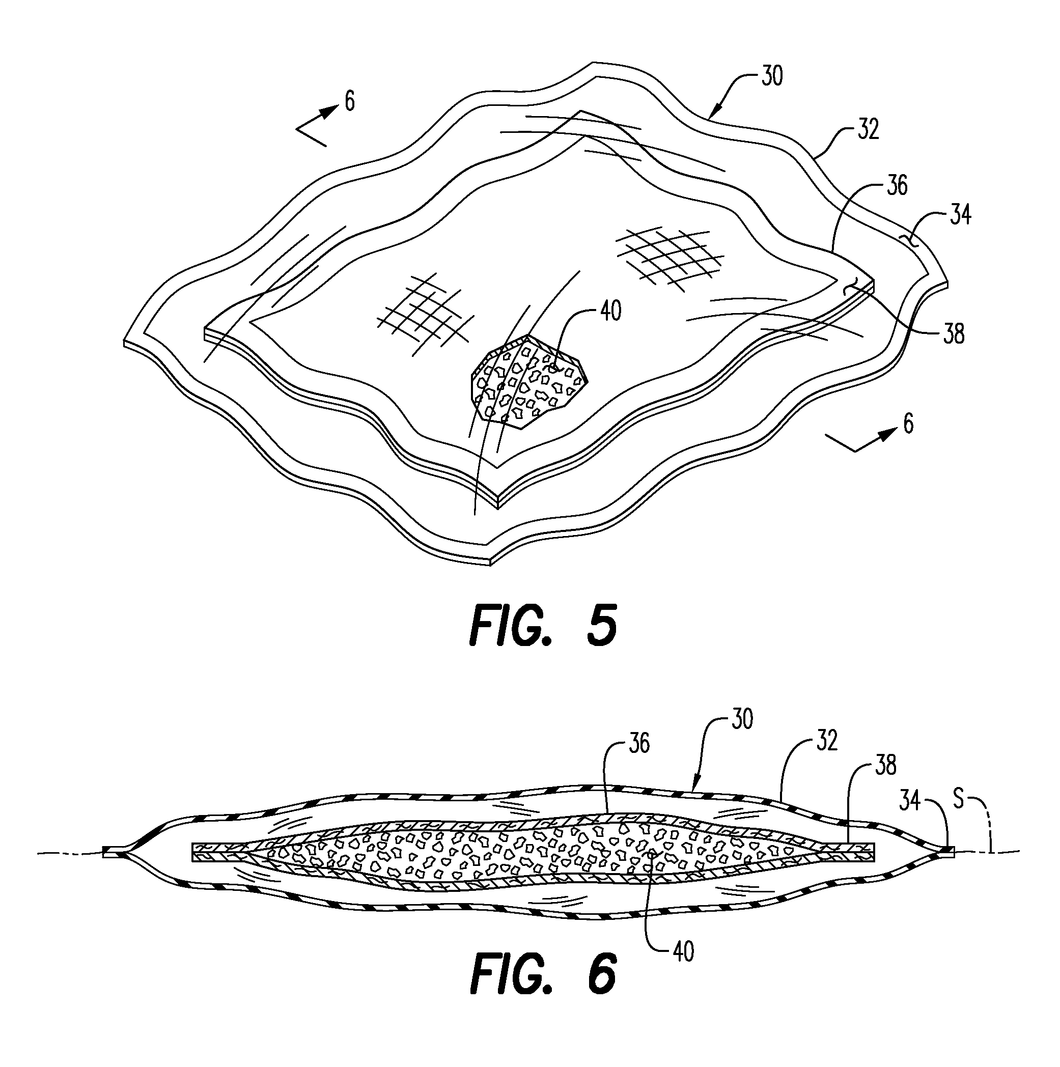 Hemostatic Wound Dressings