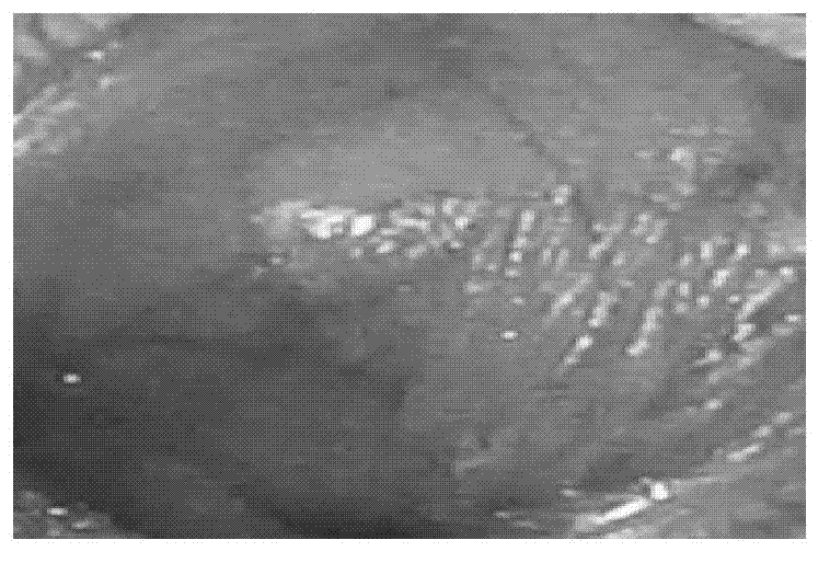 Acetylcysteine gargle for treating dental ulcers, and preparation method thereof