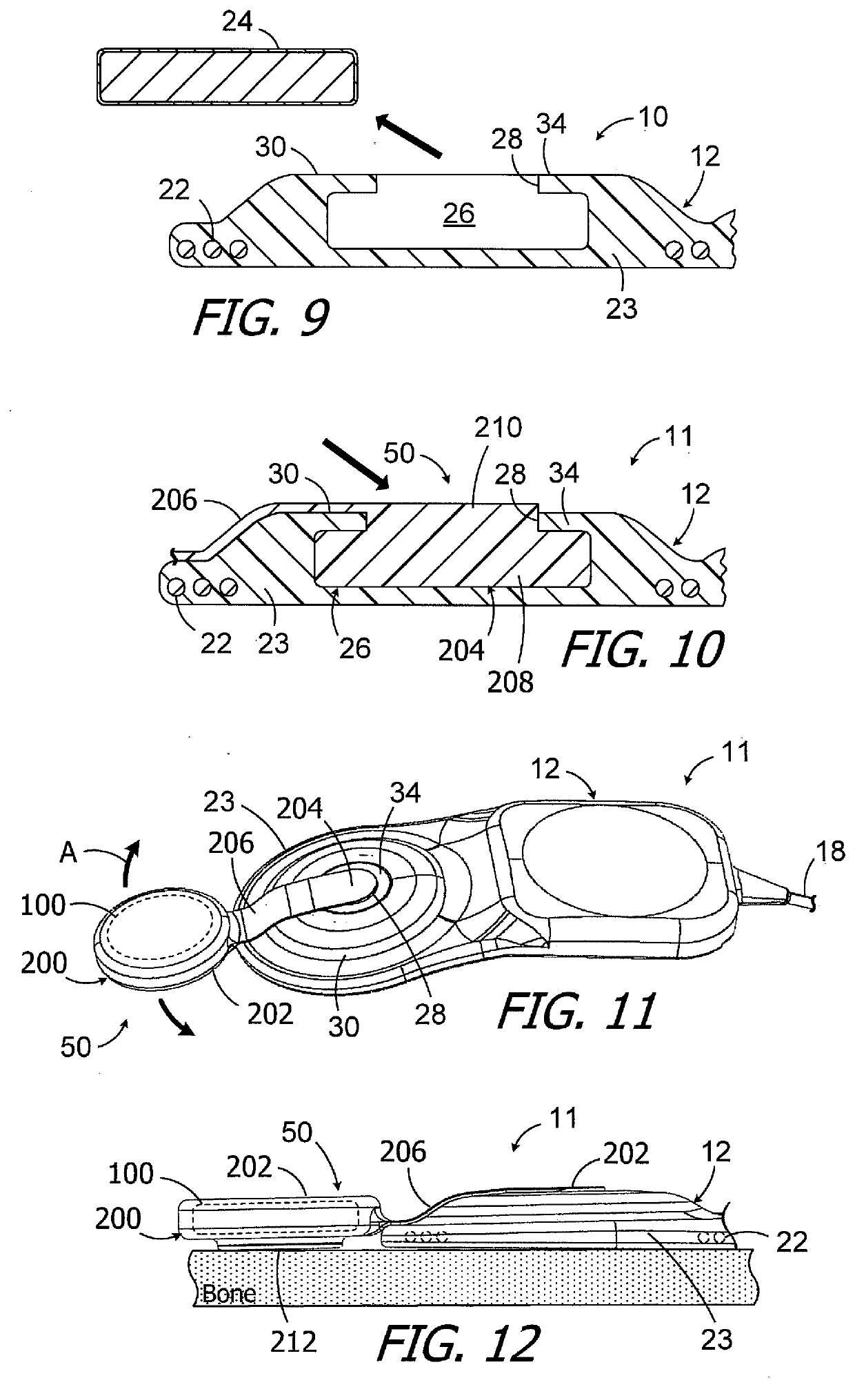 Cochlear implants, magnets for use with same and magnet retrofit methods