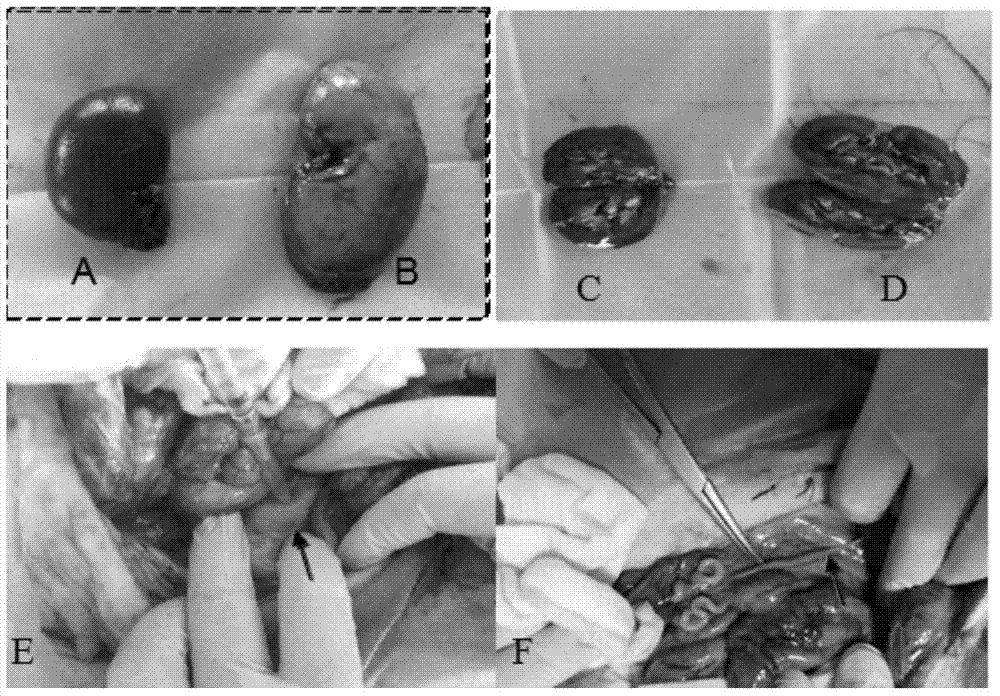 Establishment method for pig unilateral ureter obstruction recanalization model