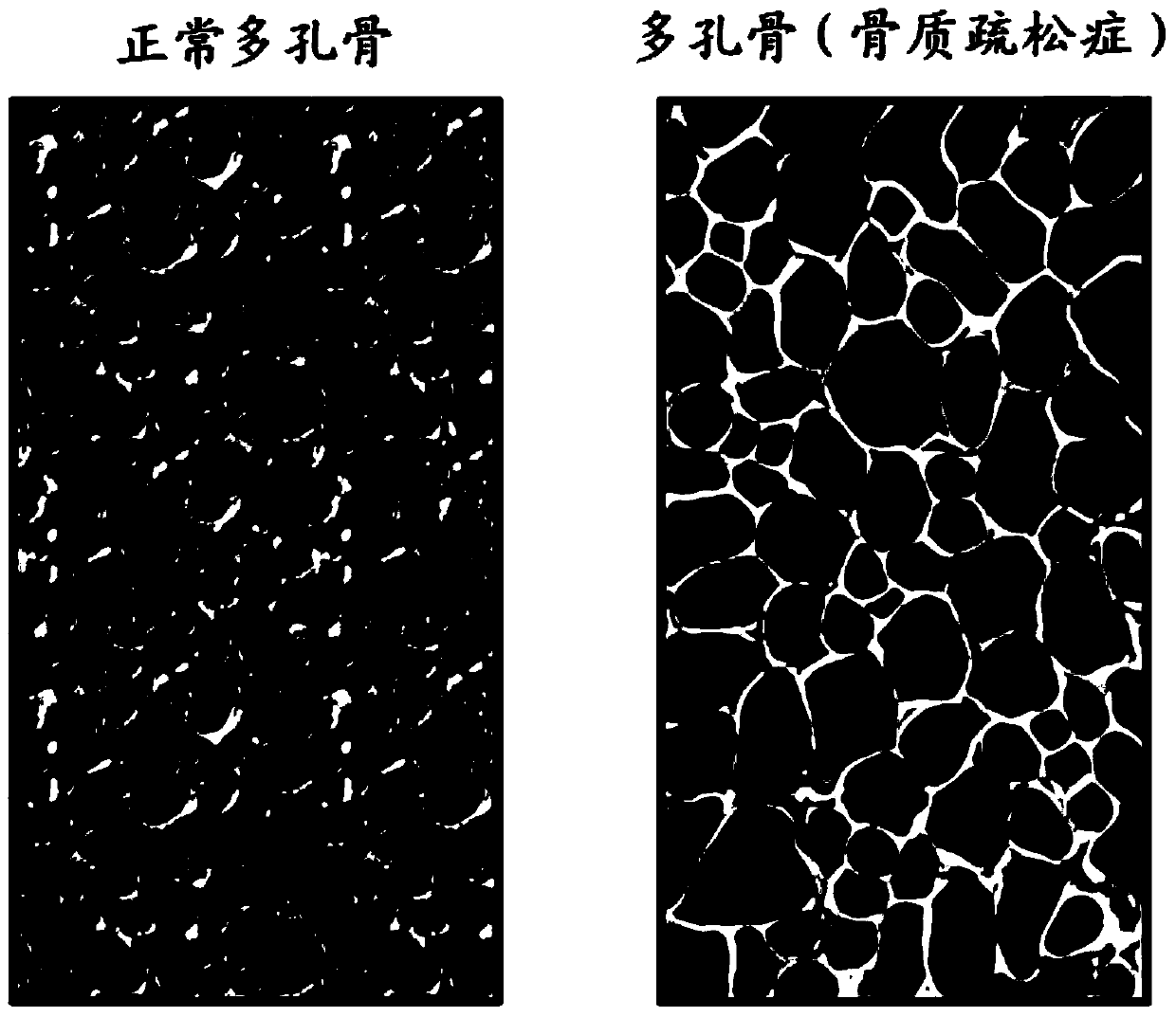 A method and device for evaluating bone collagen content based on resonance state