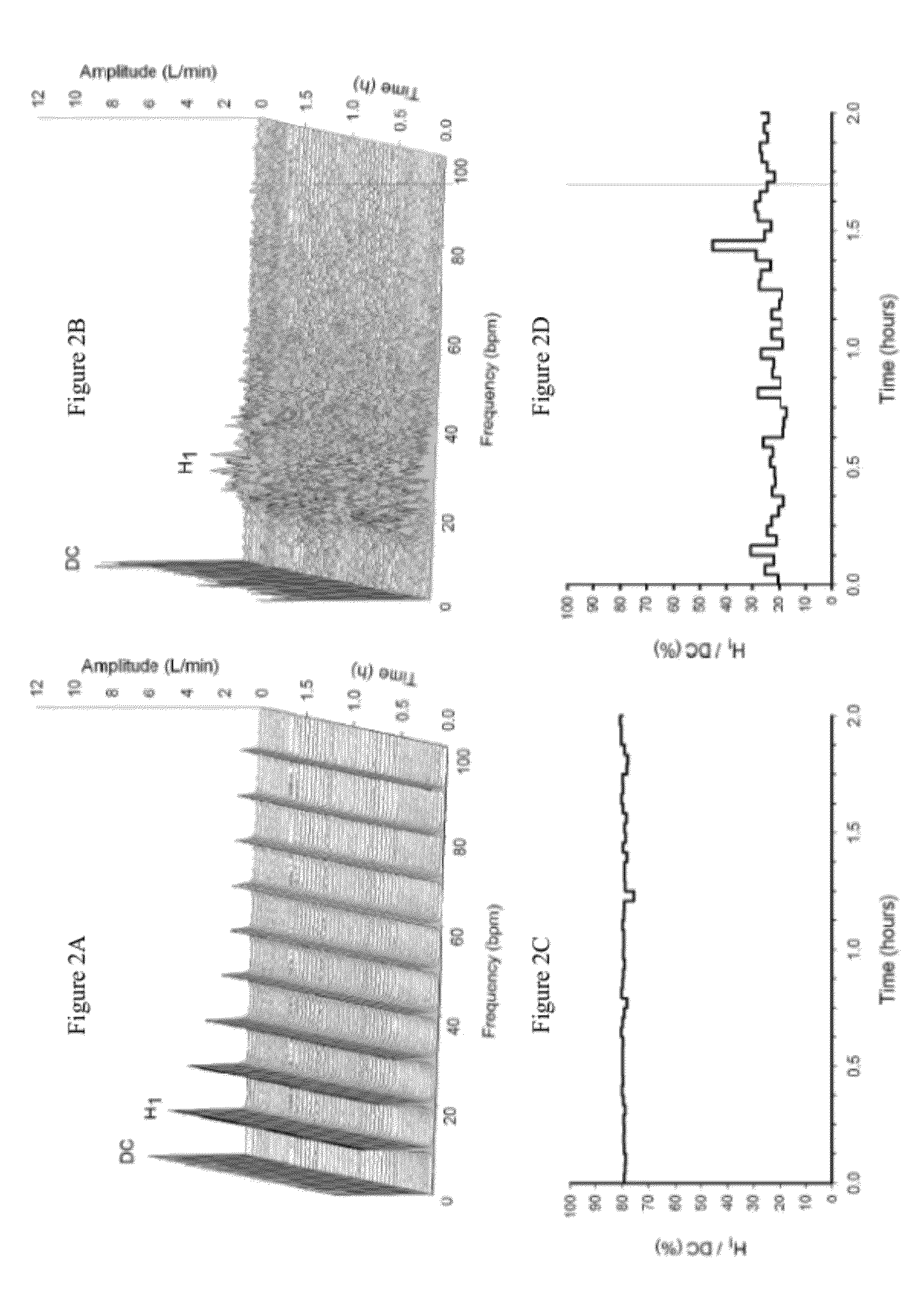 Method and system to detect respiratory asynchrony