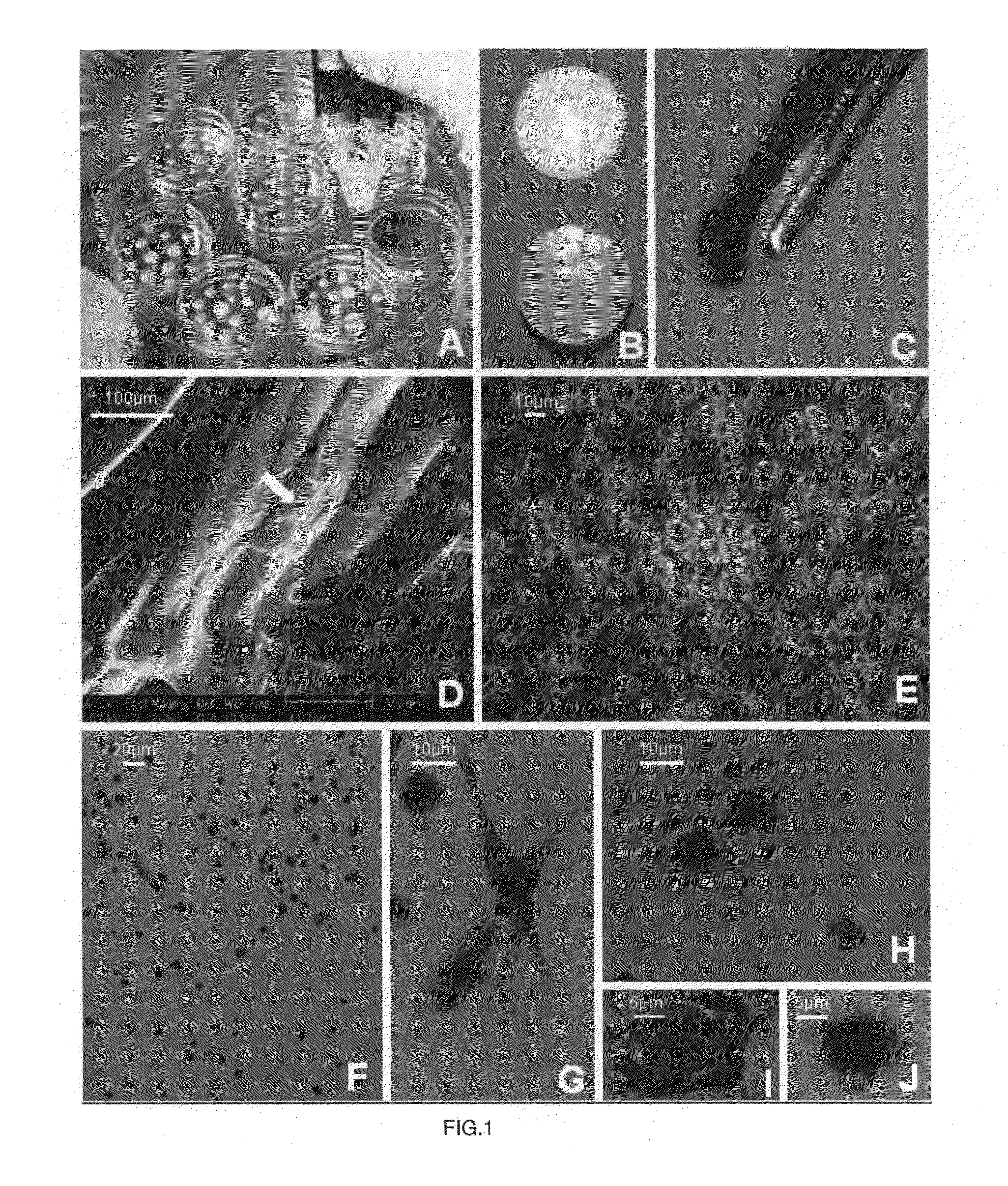 Graft composition for neural tissue regeneration, method of production and uses thereof