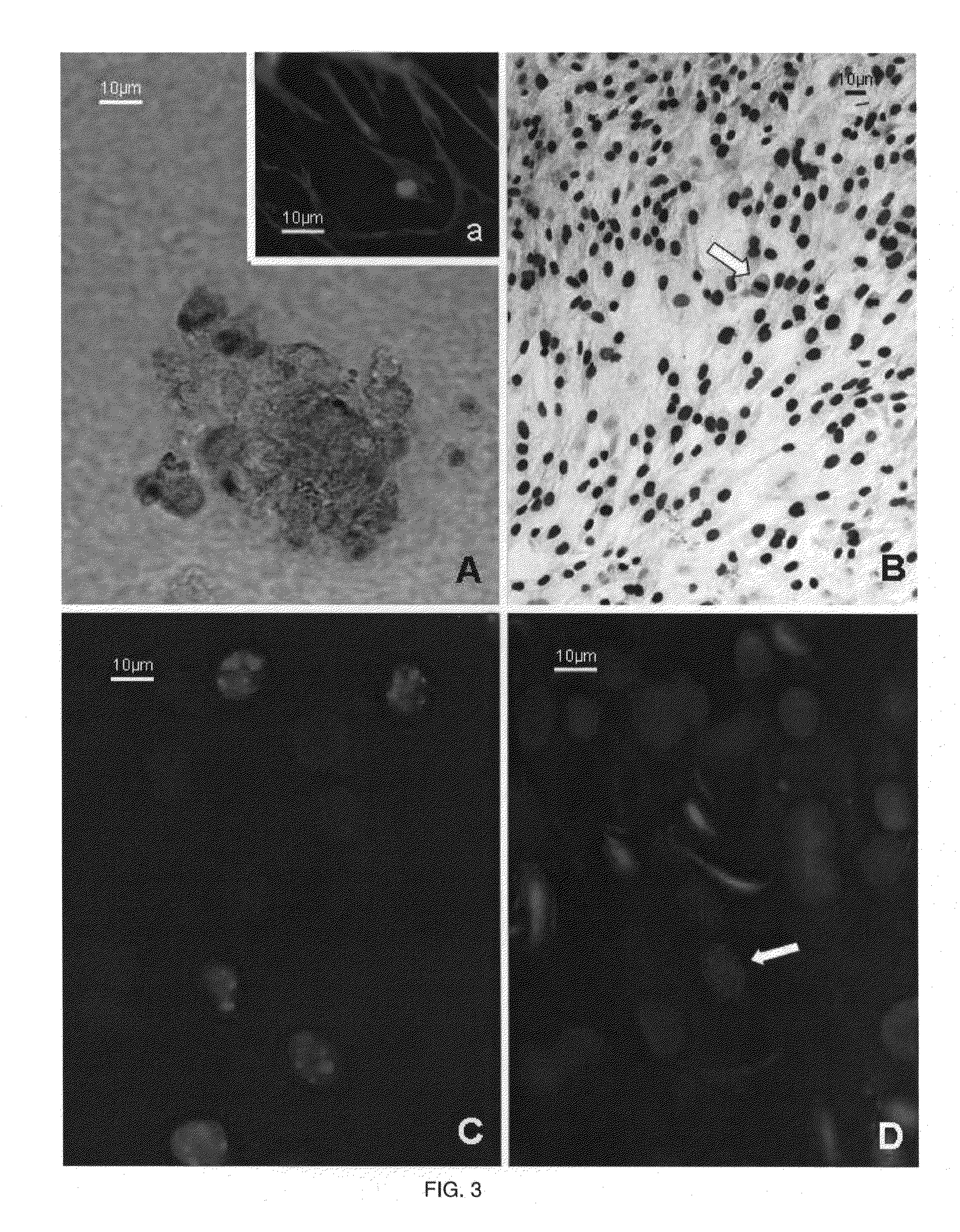 Graft composition for neural tissue regeneration, method of production and uses thereof