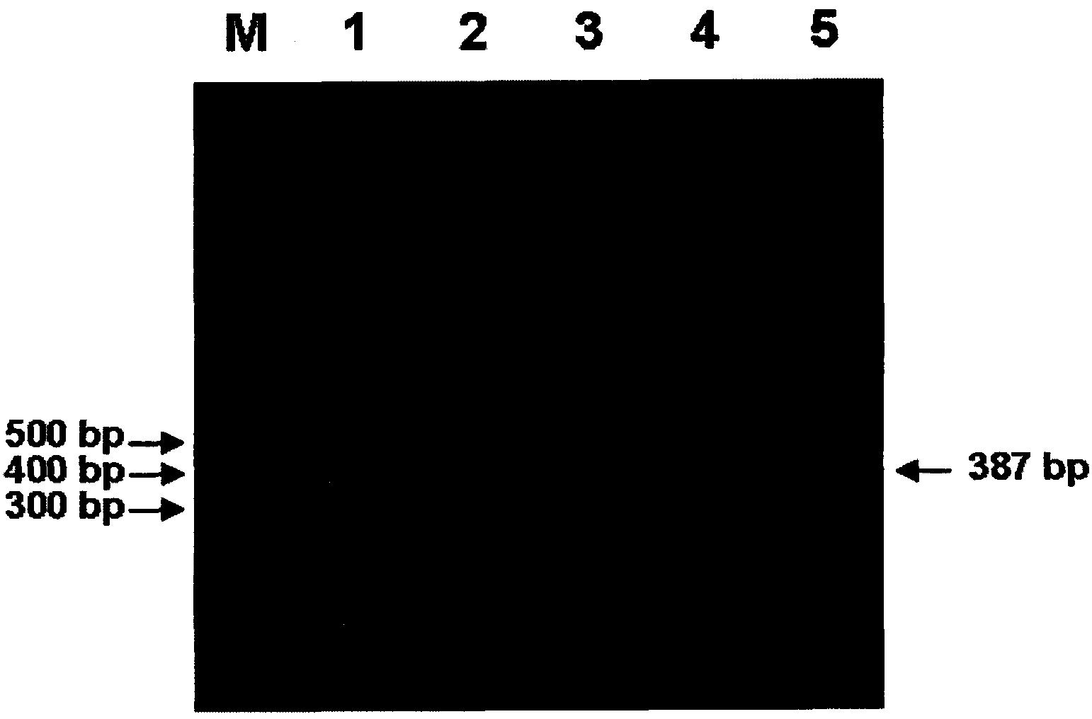 Degenerate primer and detection kit for detecting avian paramyxoviruses