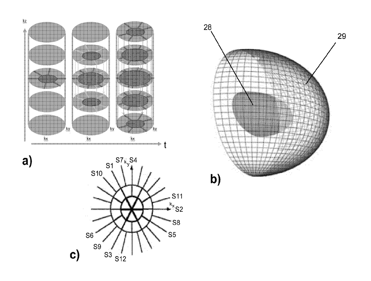 Mr imaging using a stack-of stars acquisition