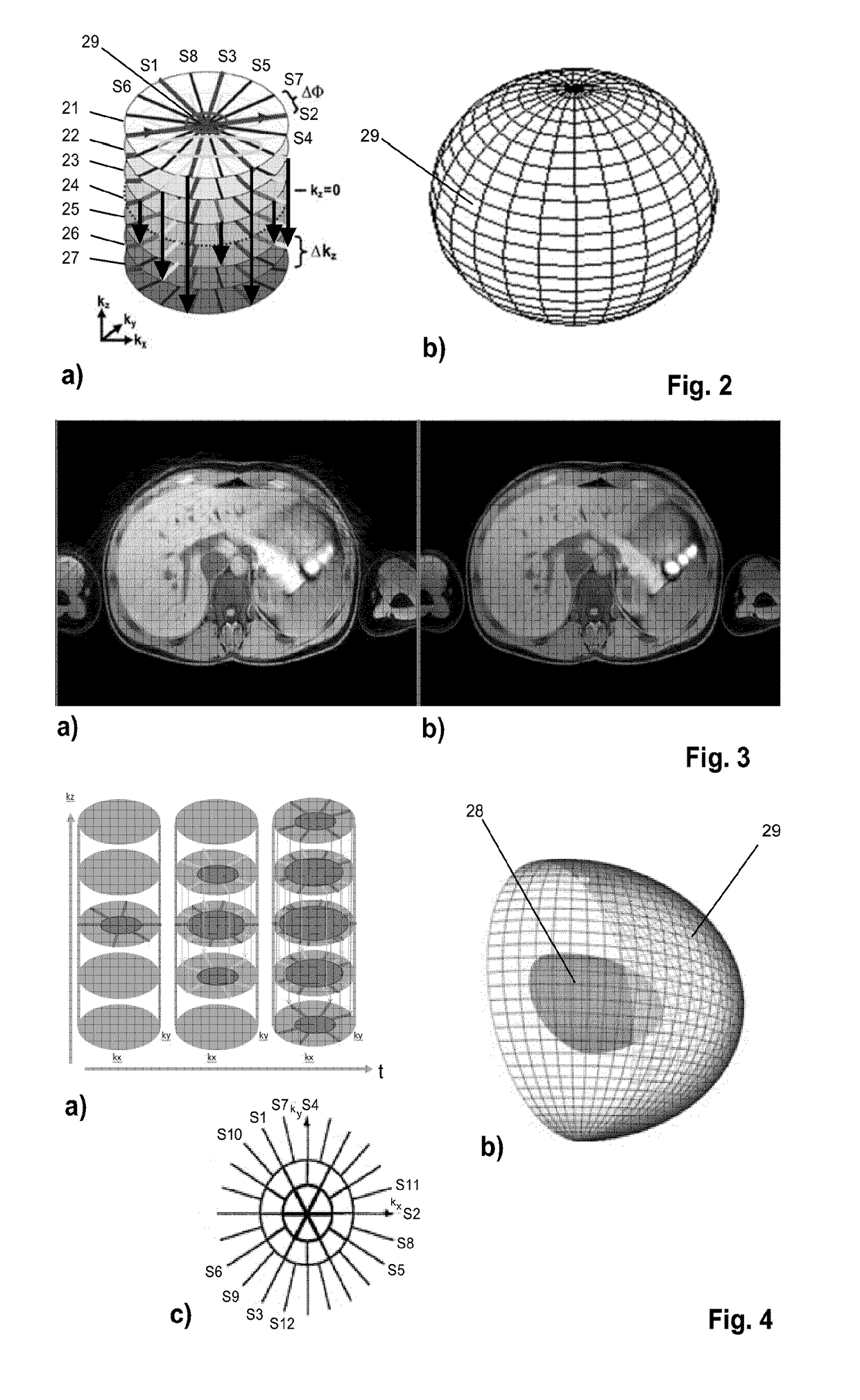 Mr imaging using a stack-of stars acquisition