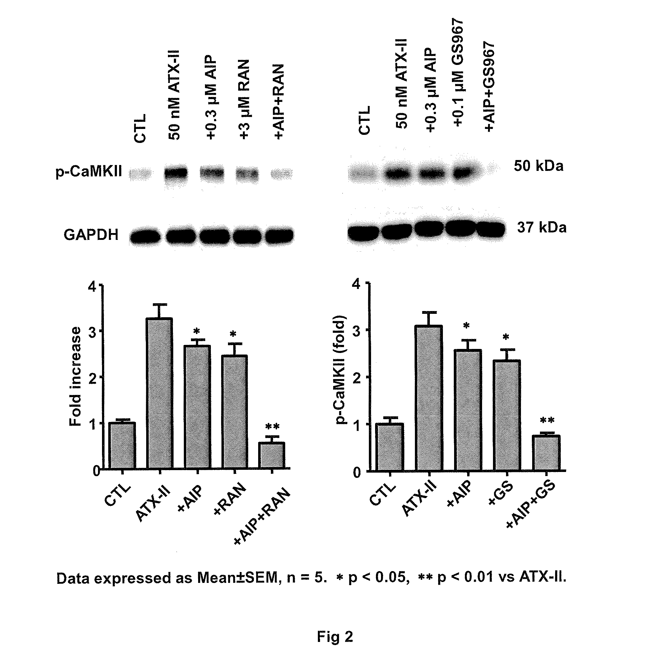 Combination therapy for the treatment of arrhythmias or heart failure