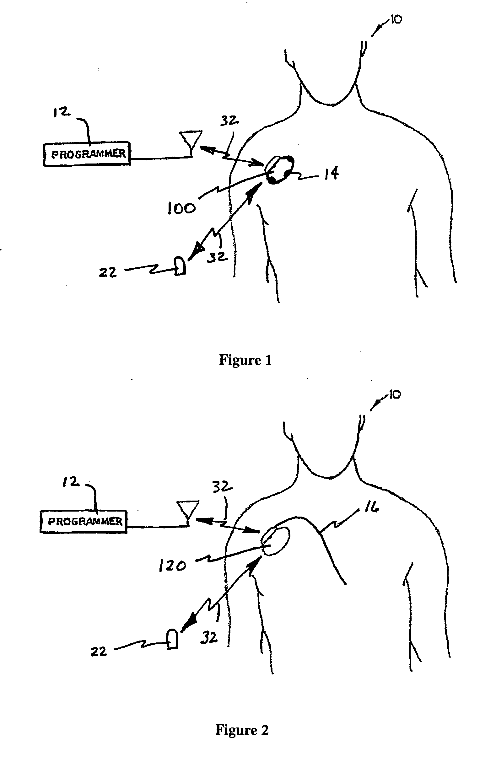 System and method for regulating cardiopulmanary triggered therapy to the brain