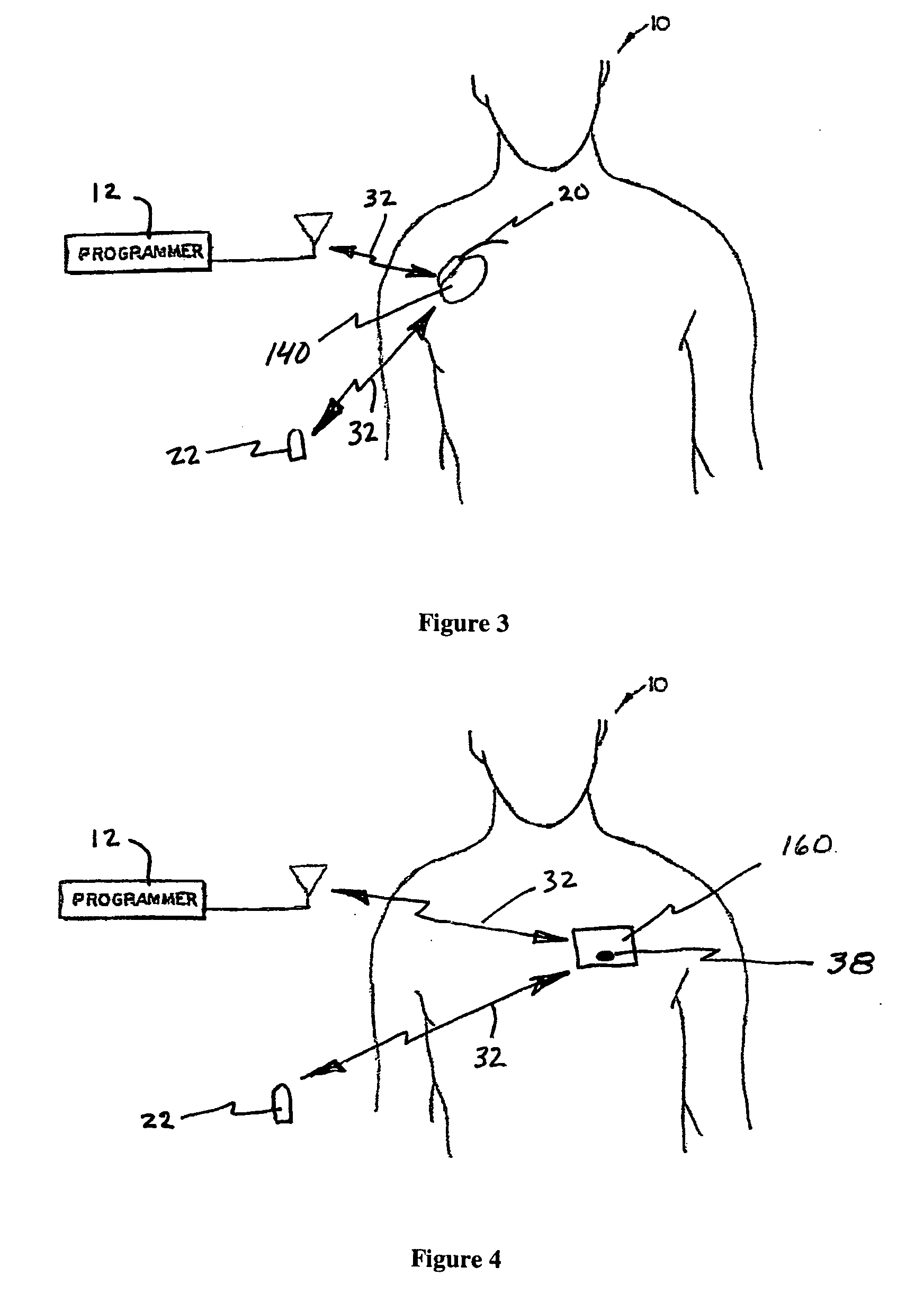 System and method for regulating cardiopulmanary triggered therapy to the brain