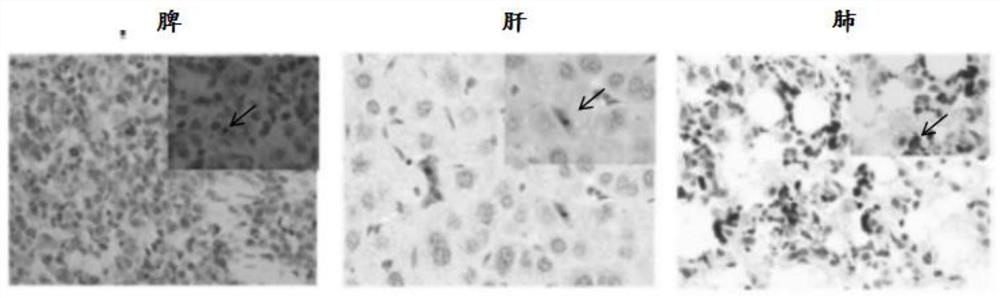 A humanized mouse model of cytomegalovirus infection and its construction method