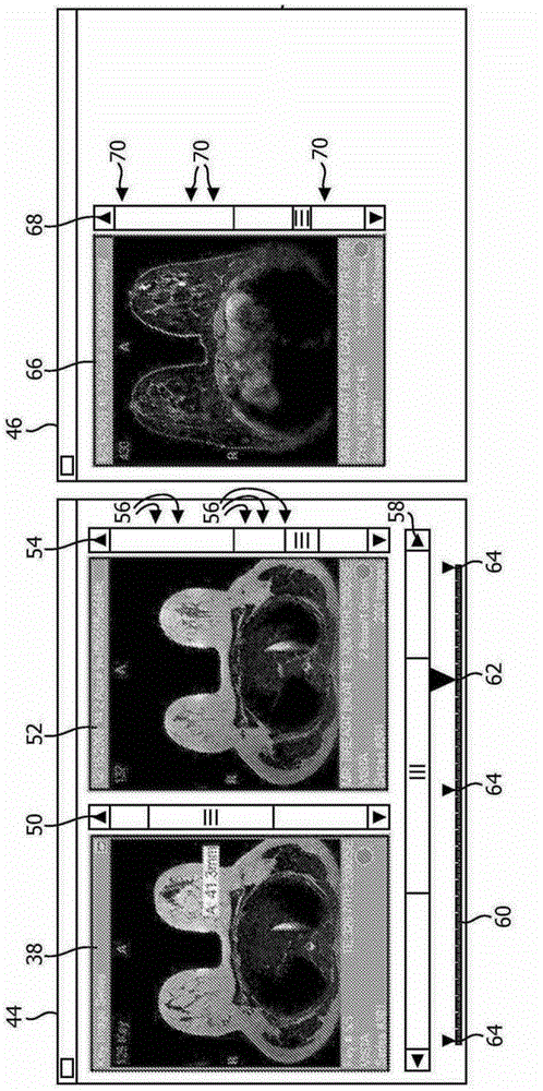 Medical image navigation