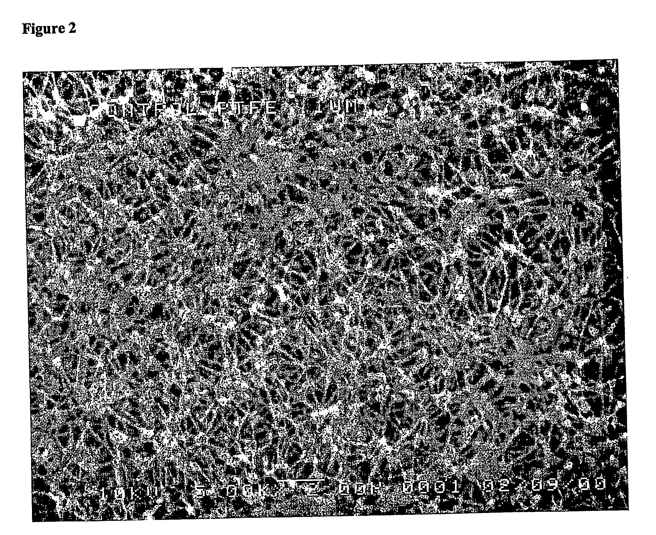 Preparation of asymmetric membranes using hot-filament chemical vapor deposition