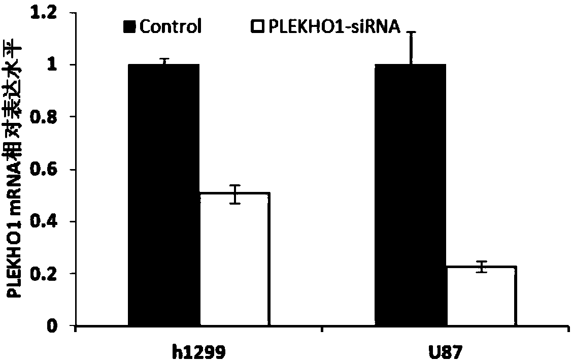 Application of human PLEKHO1 gene and related medicines thereof