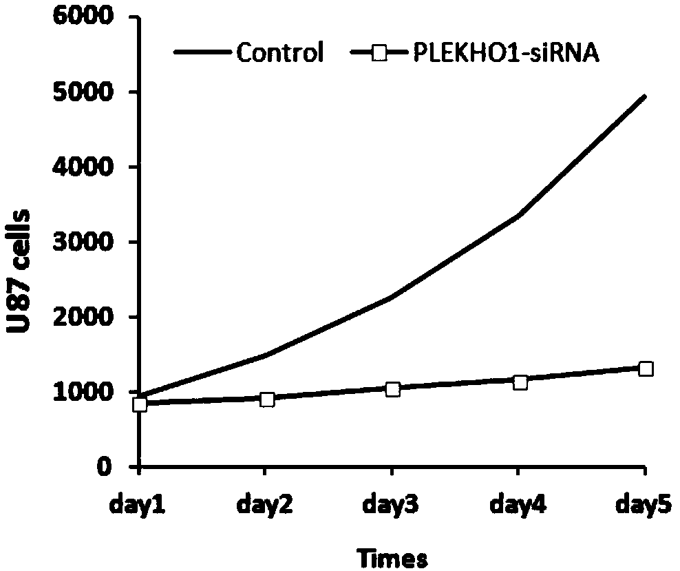 Application of human PLEKHO1 gene and related medicines thereof