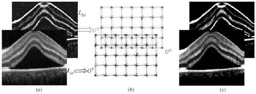 Segmentation method of oct image layer based on random forest and compound activity curve