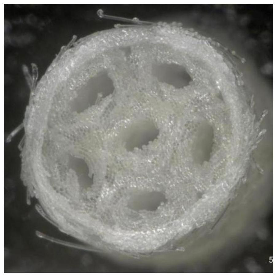 Method for preparing multi-channel antibacterial nerve guide by variable spindle braiding method