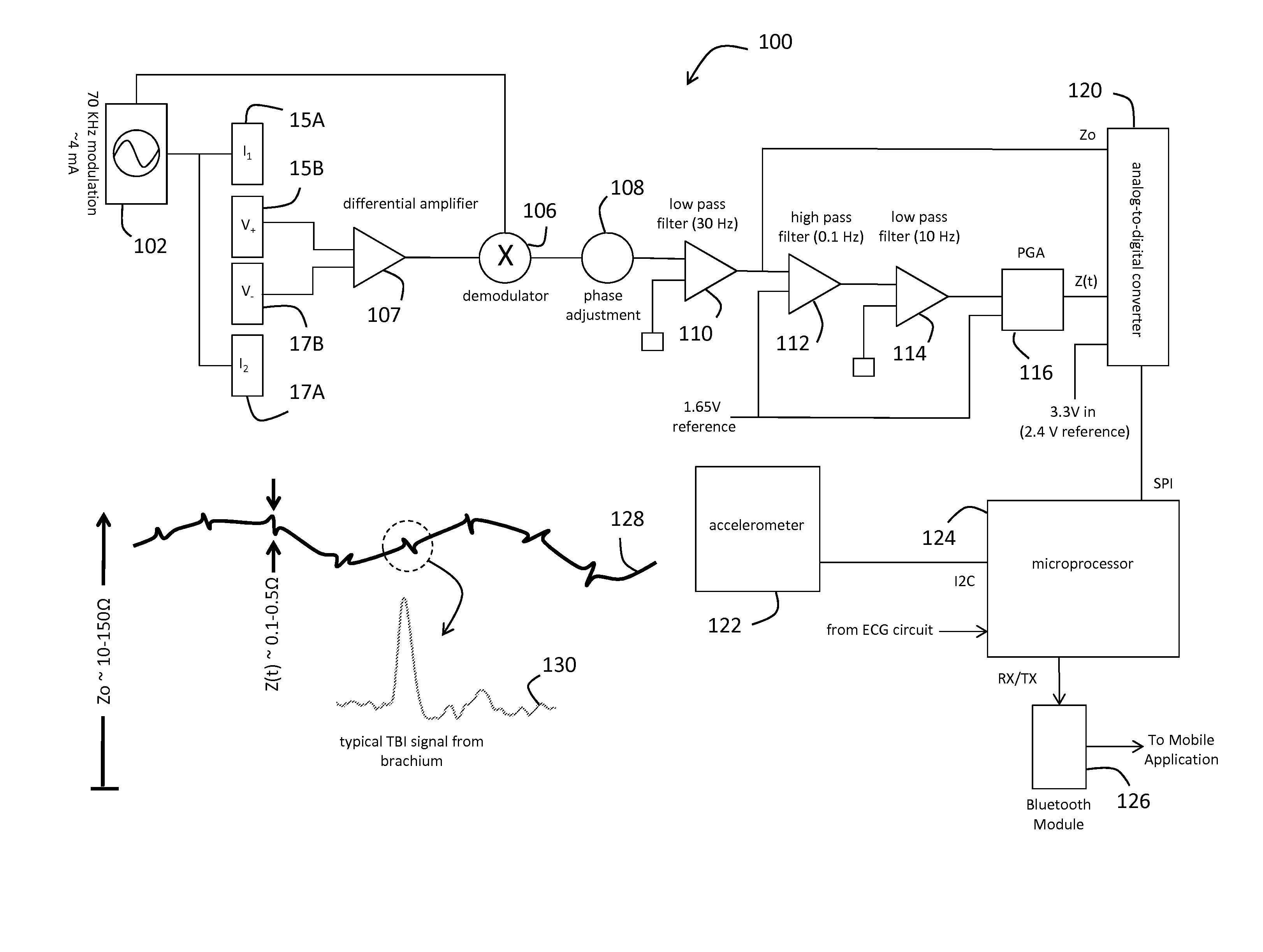 System for electrophysiology that includes software module and body-worn monitor