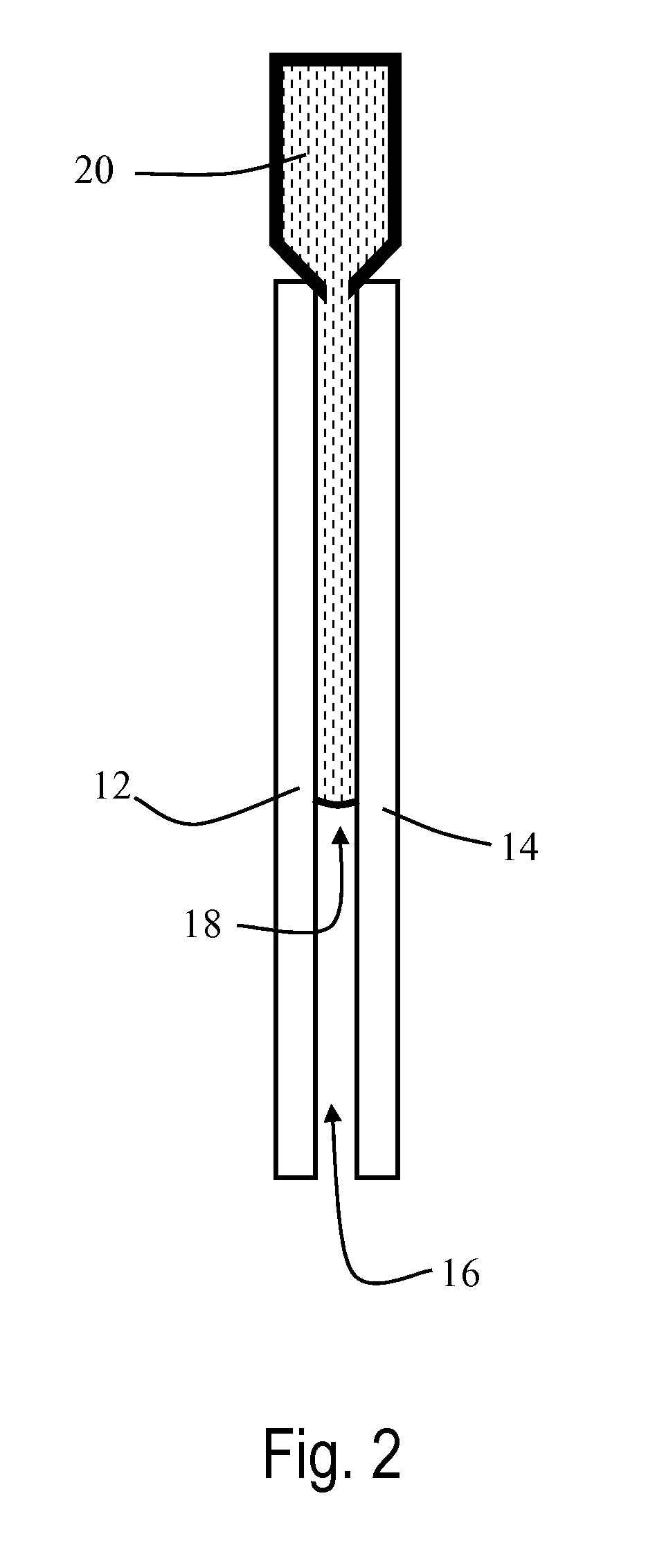 Injection molded multiple layer glazings