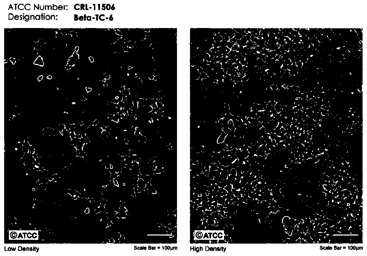 Artificial islet or artificial pancreas and preparation method thereof