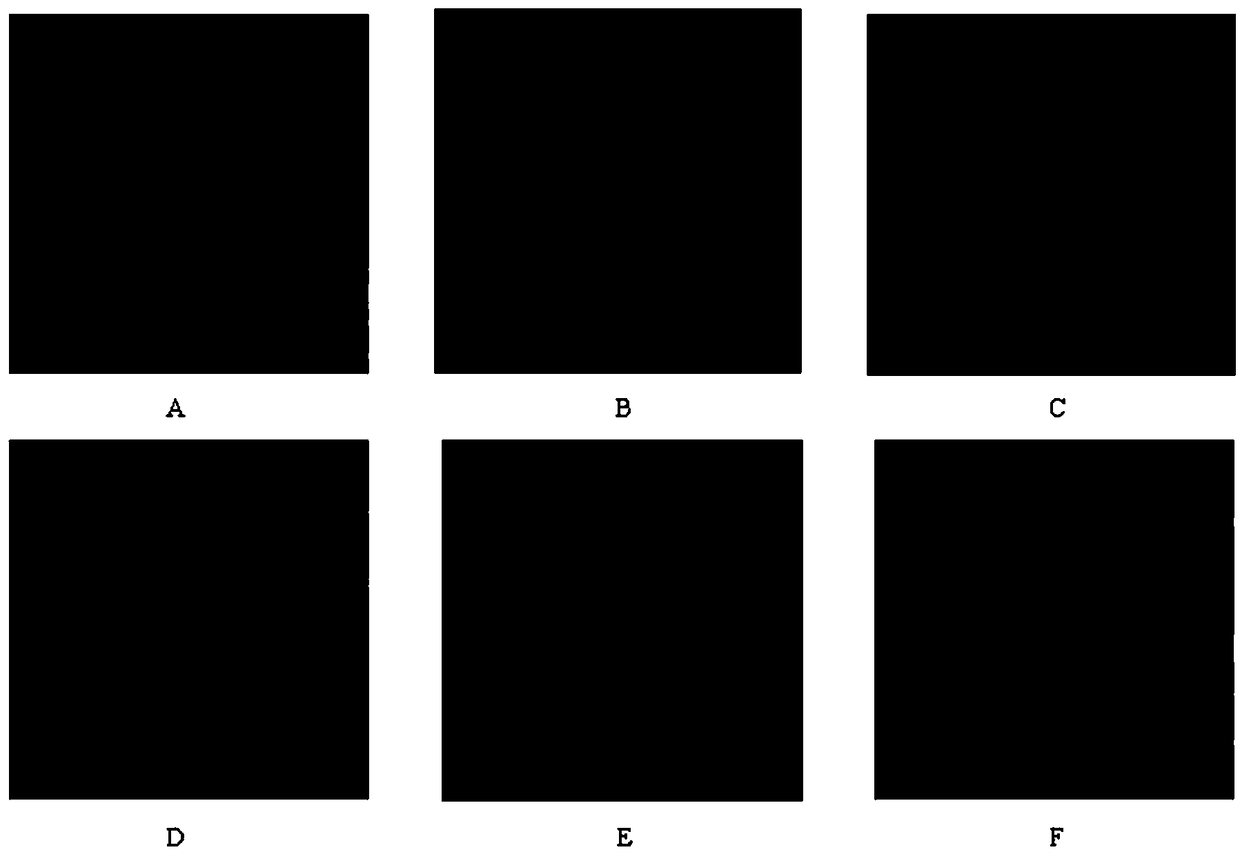 Detection method of medicine for inhibiting human breast cancer cell proliferation