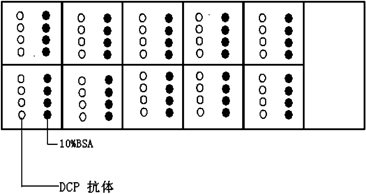 Protein chip and kit for detecting abnormal DCP (Des--Carboxy-Prothrombin) in serum and preparation method thereof