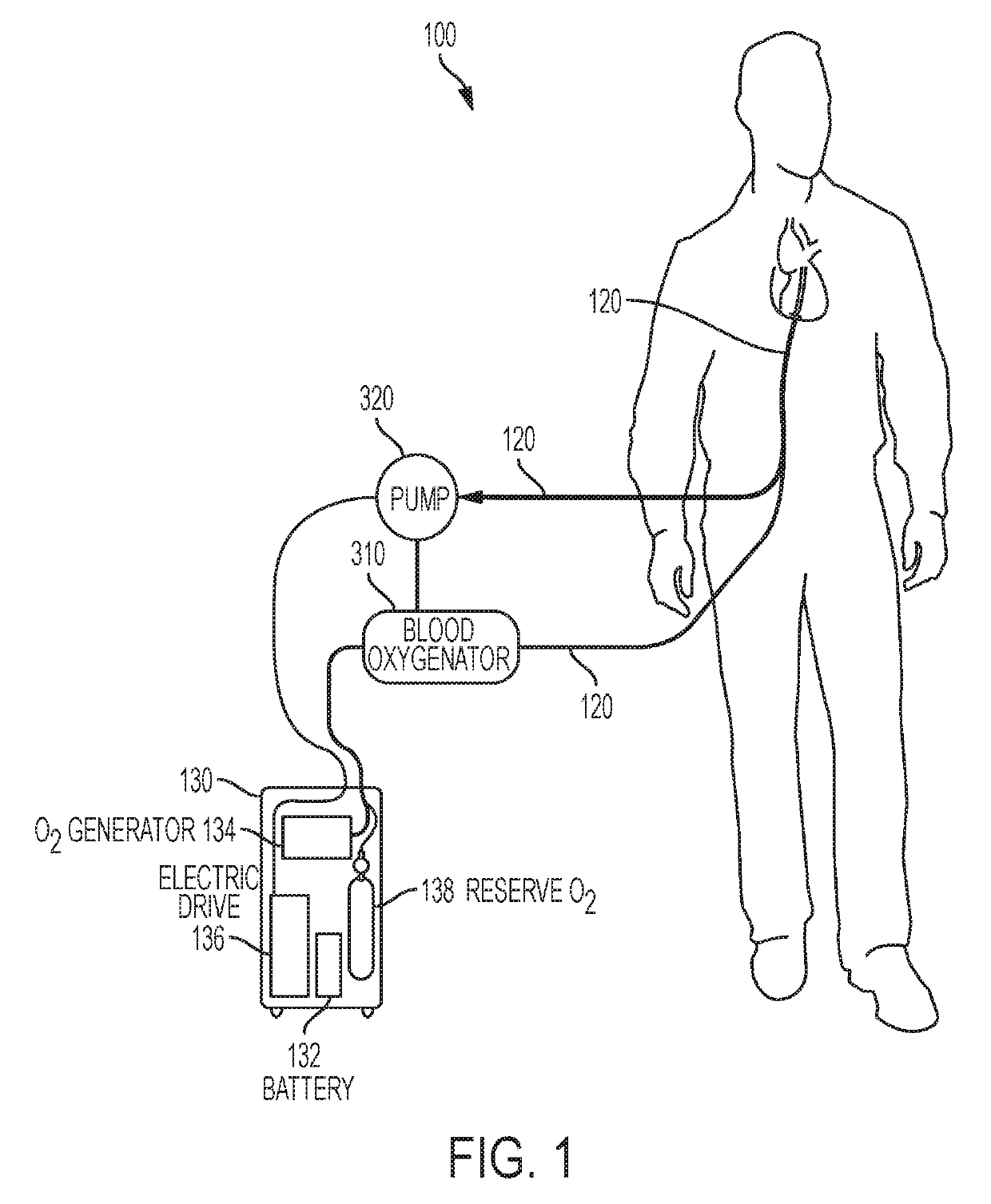 Artificial lung system and its methods of use