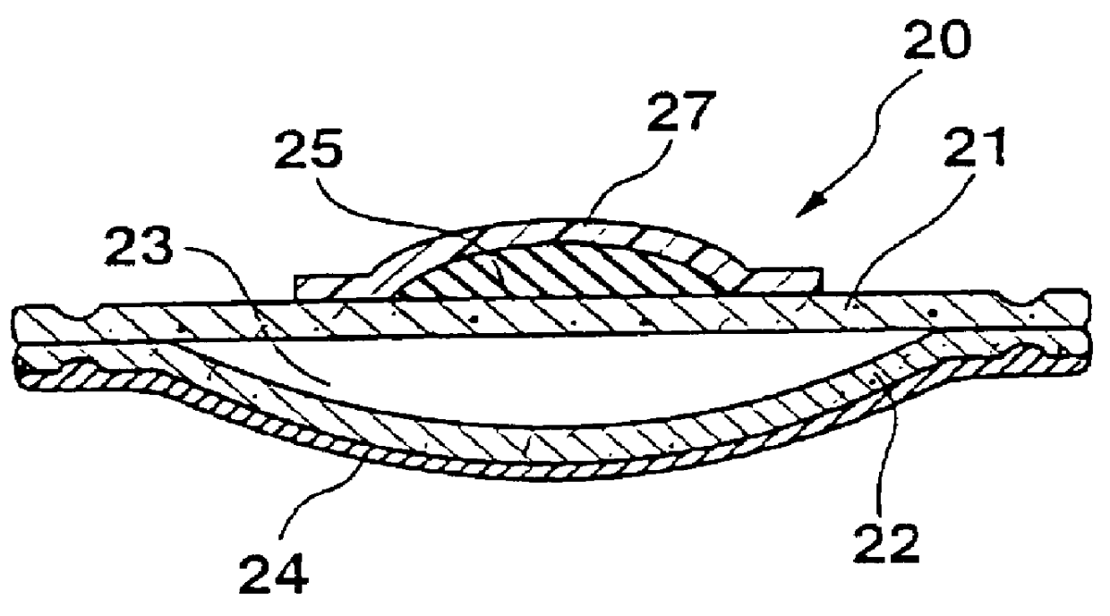 Puncture closure