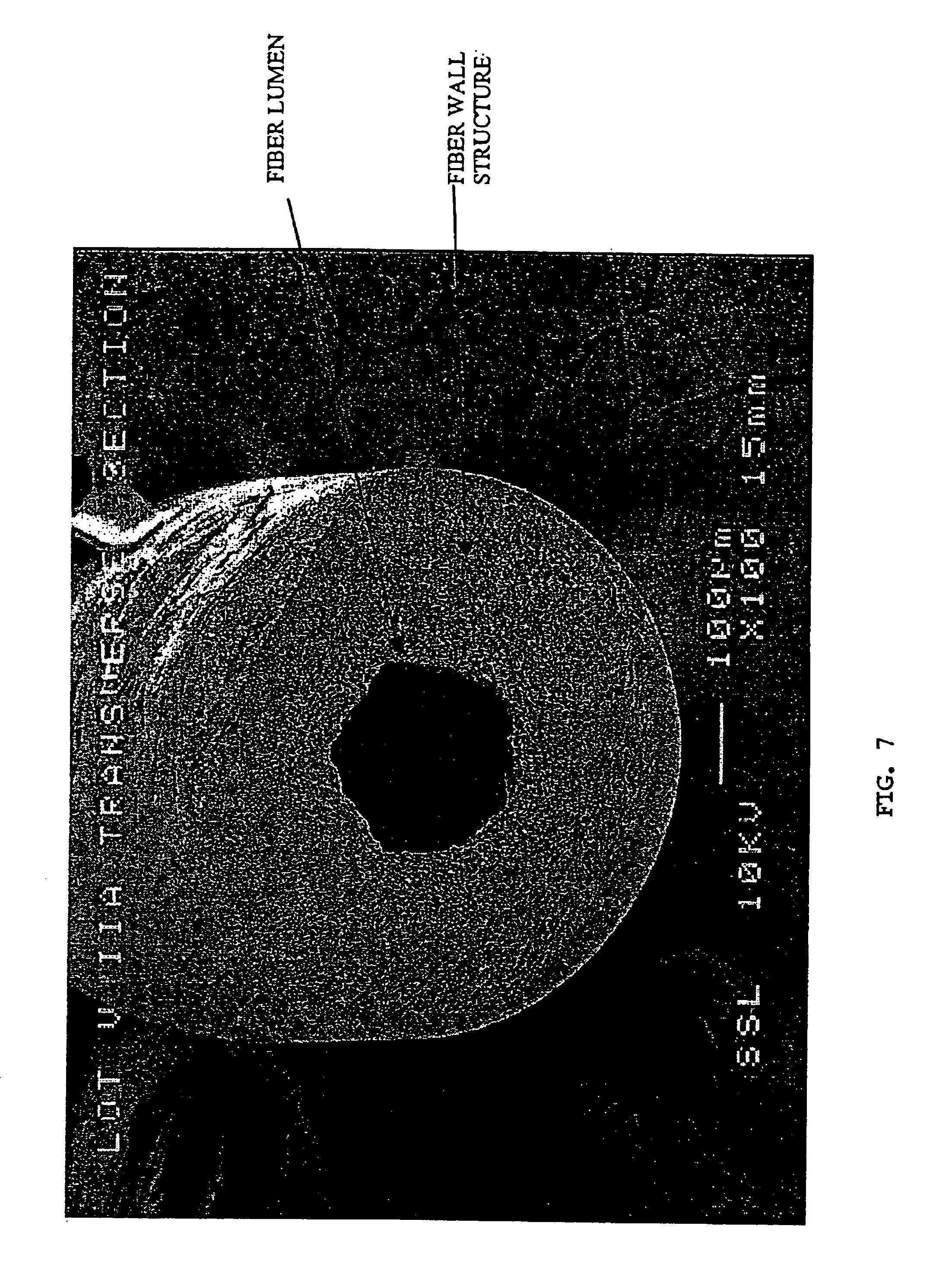 Plasmapheresis filter device and catheter assembly