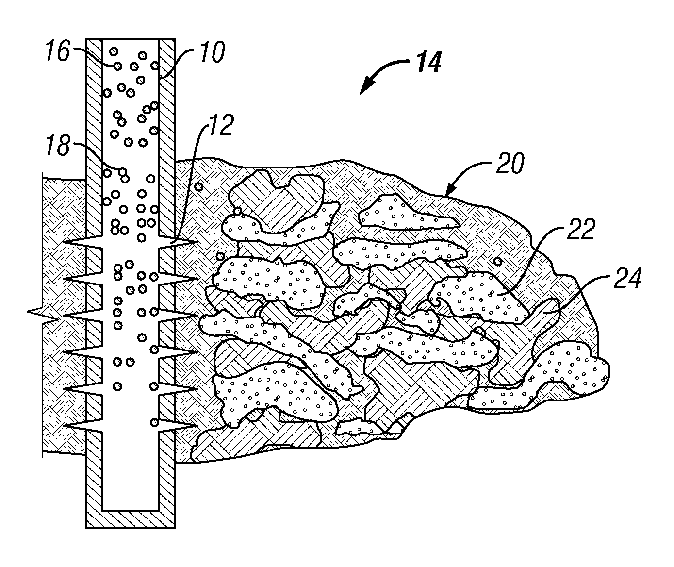 Heterogeneous Proppant Placement in a Fracture with Removable Channelant Fill