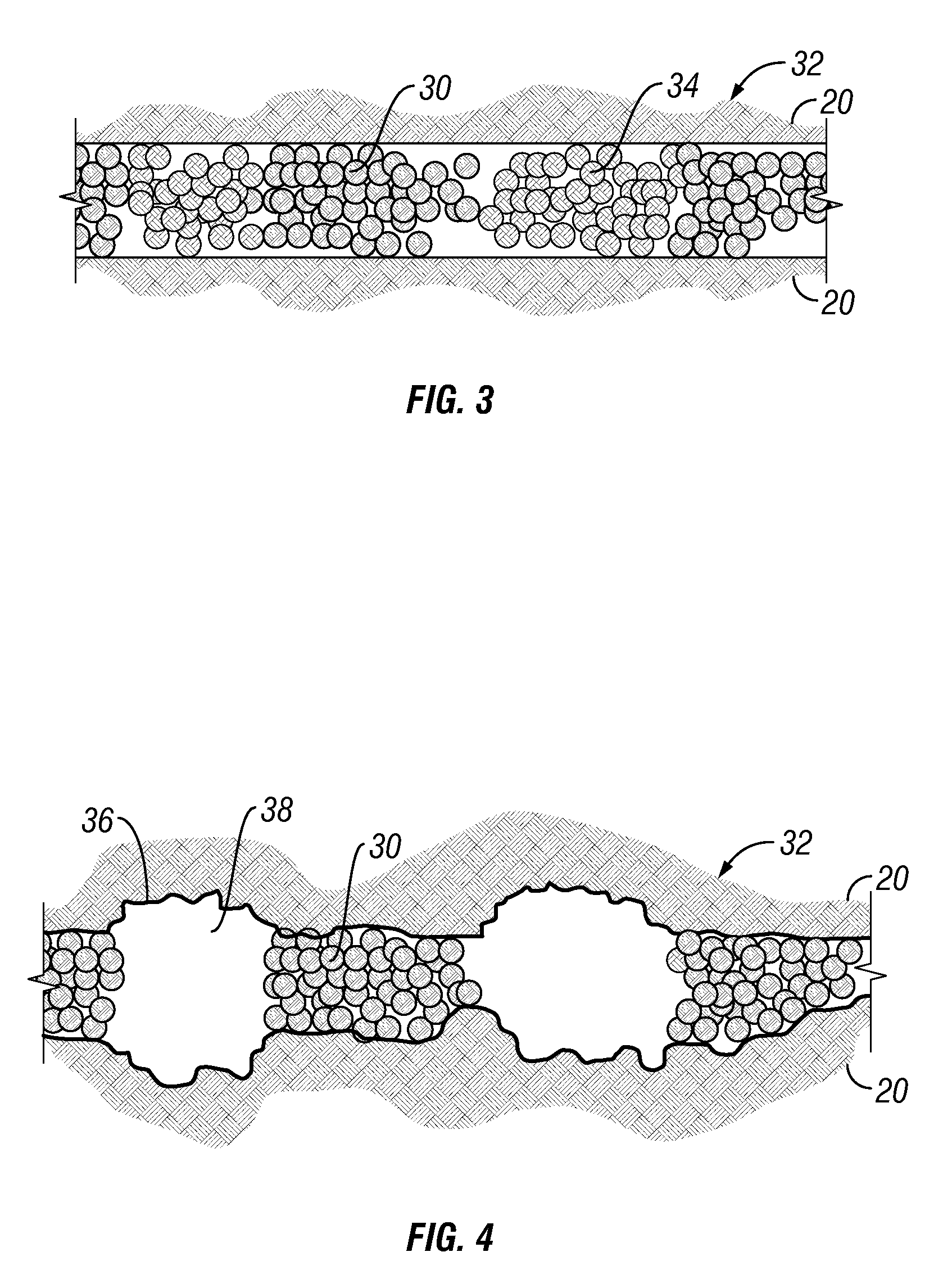 Heterogeneous Proppant Placement in a Fracture with Removable Channelant Fill