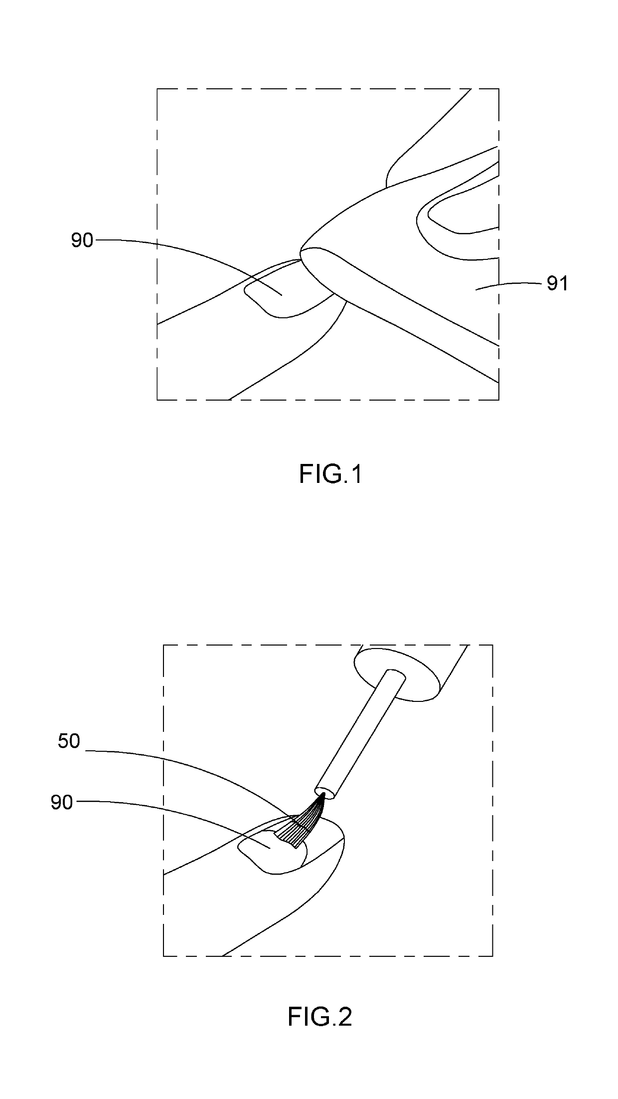 Artificial Nail Tip and Curing Composition Set and Applying Method Thereof