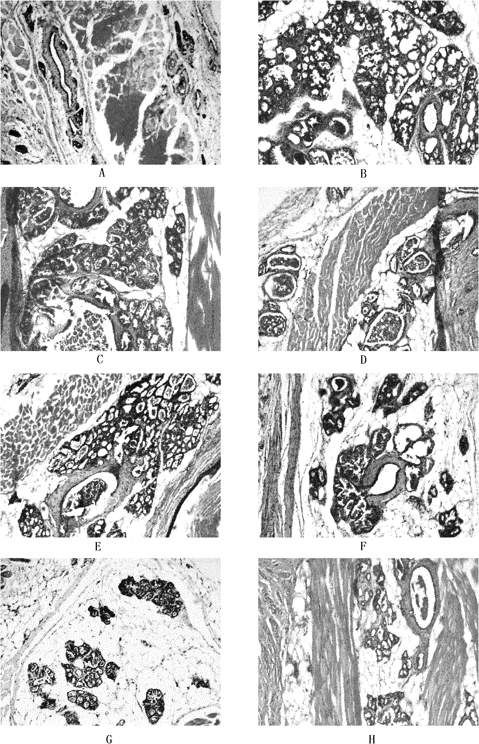 Cream preparation for preventing and curing mammary gland hyperplasia and preparation method thereof