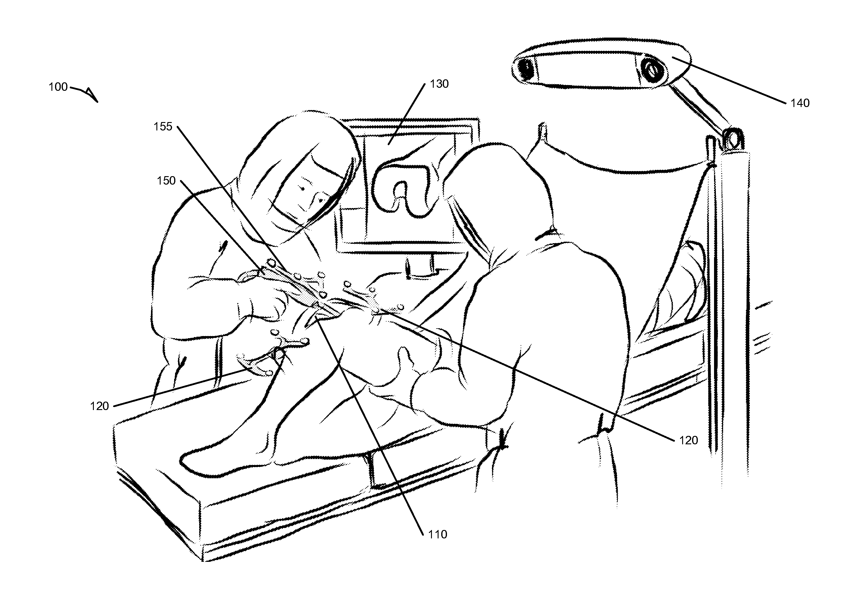 Systems and methods for planning and performing image free implant revision surgery