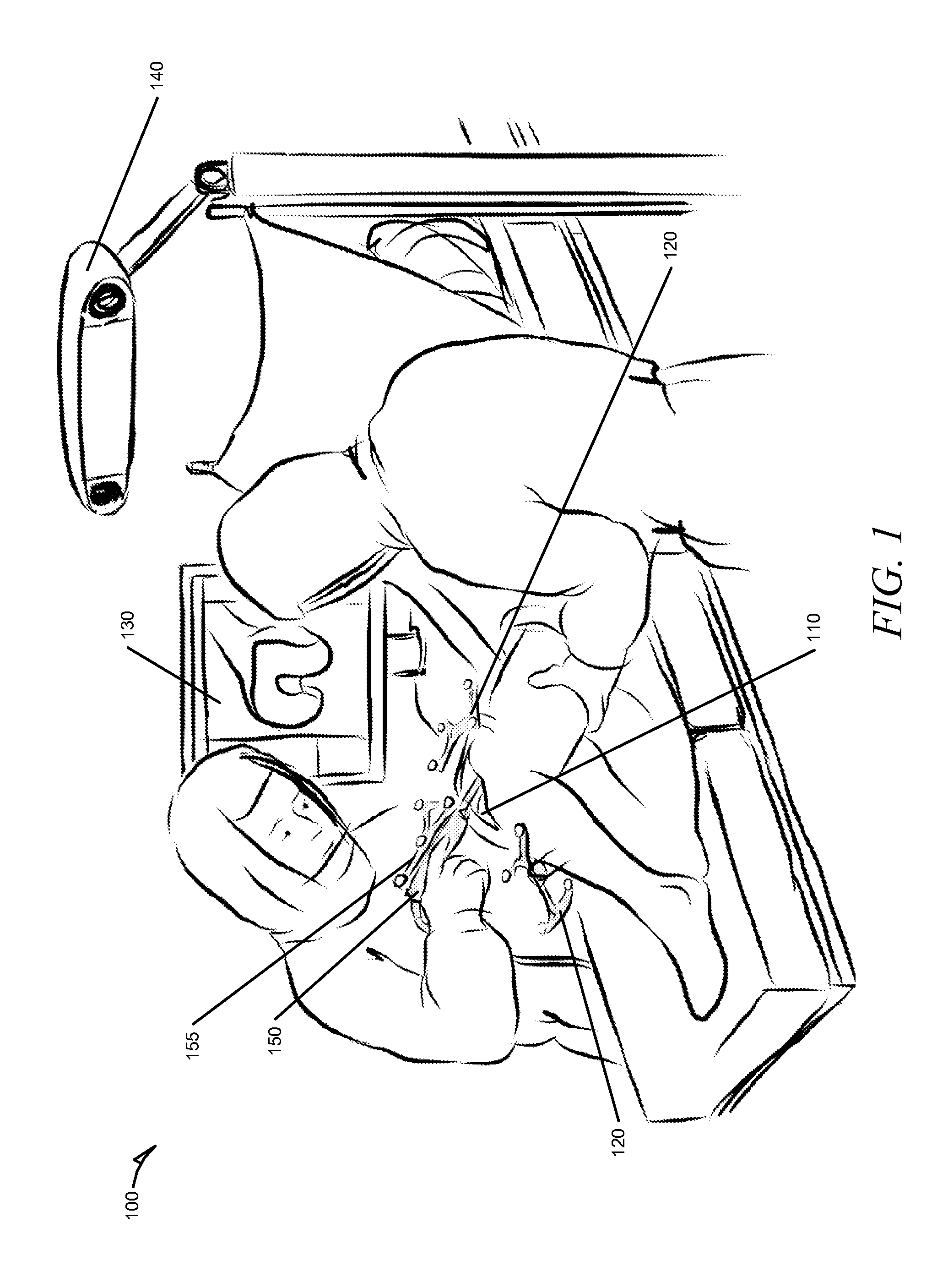 Systems and methods for planning and performing image free implant revision surgery