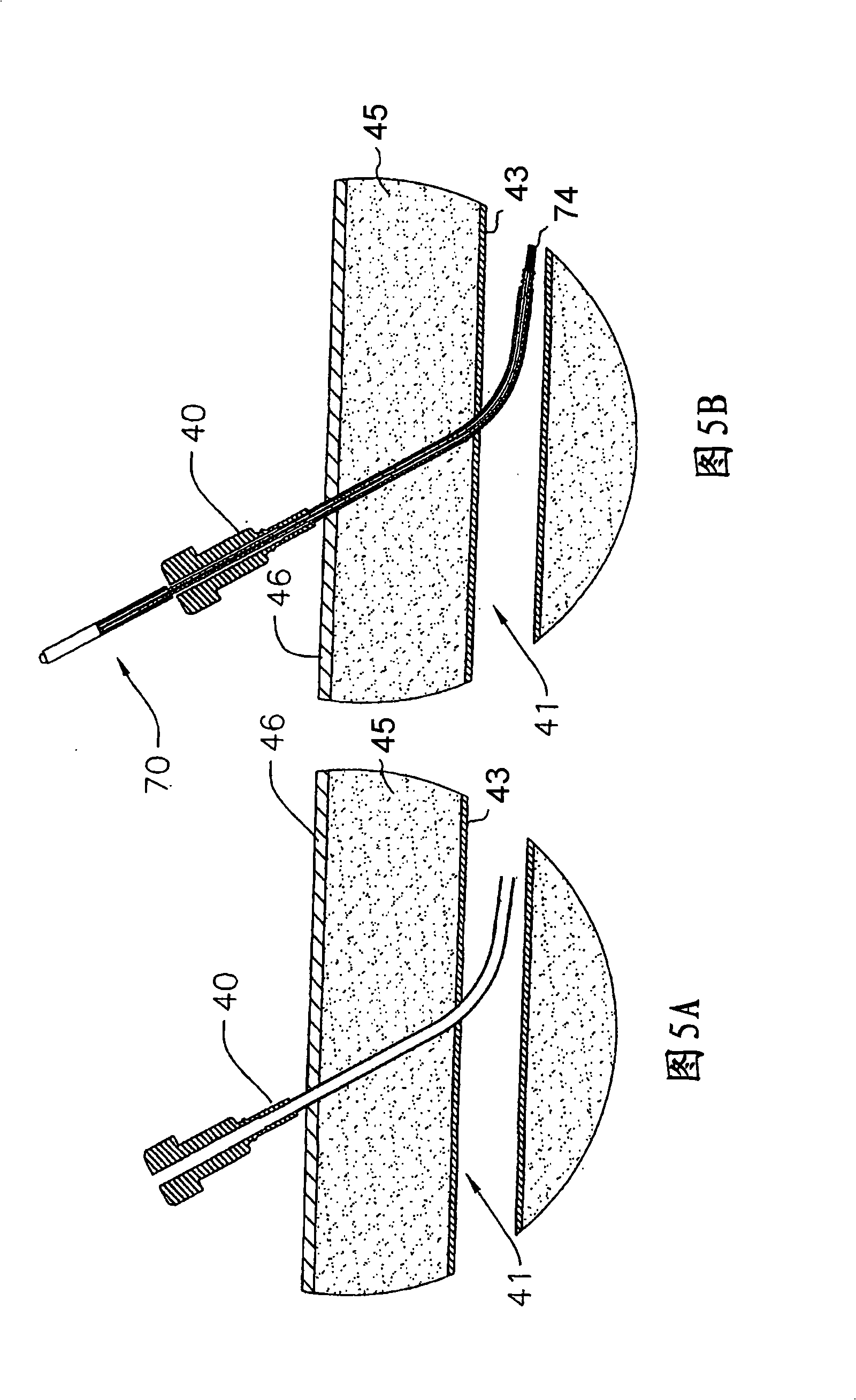 Drug eluting vascular closure devices and methods