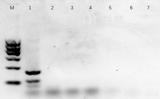 Primer, probe and kit for detecting pneumocystis carinii and toxoplasma gondii and detection method thereof