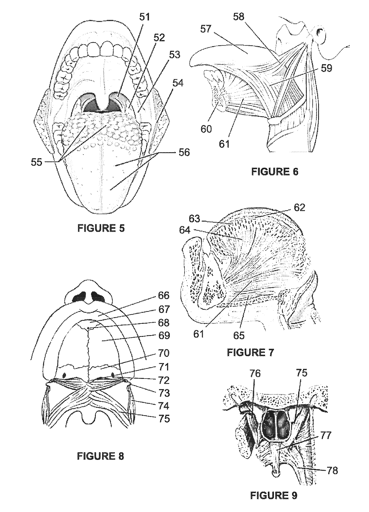 Oral muscle training