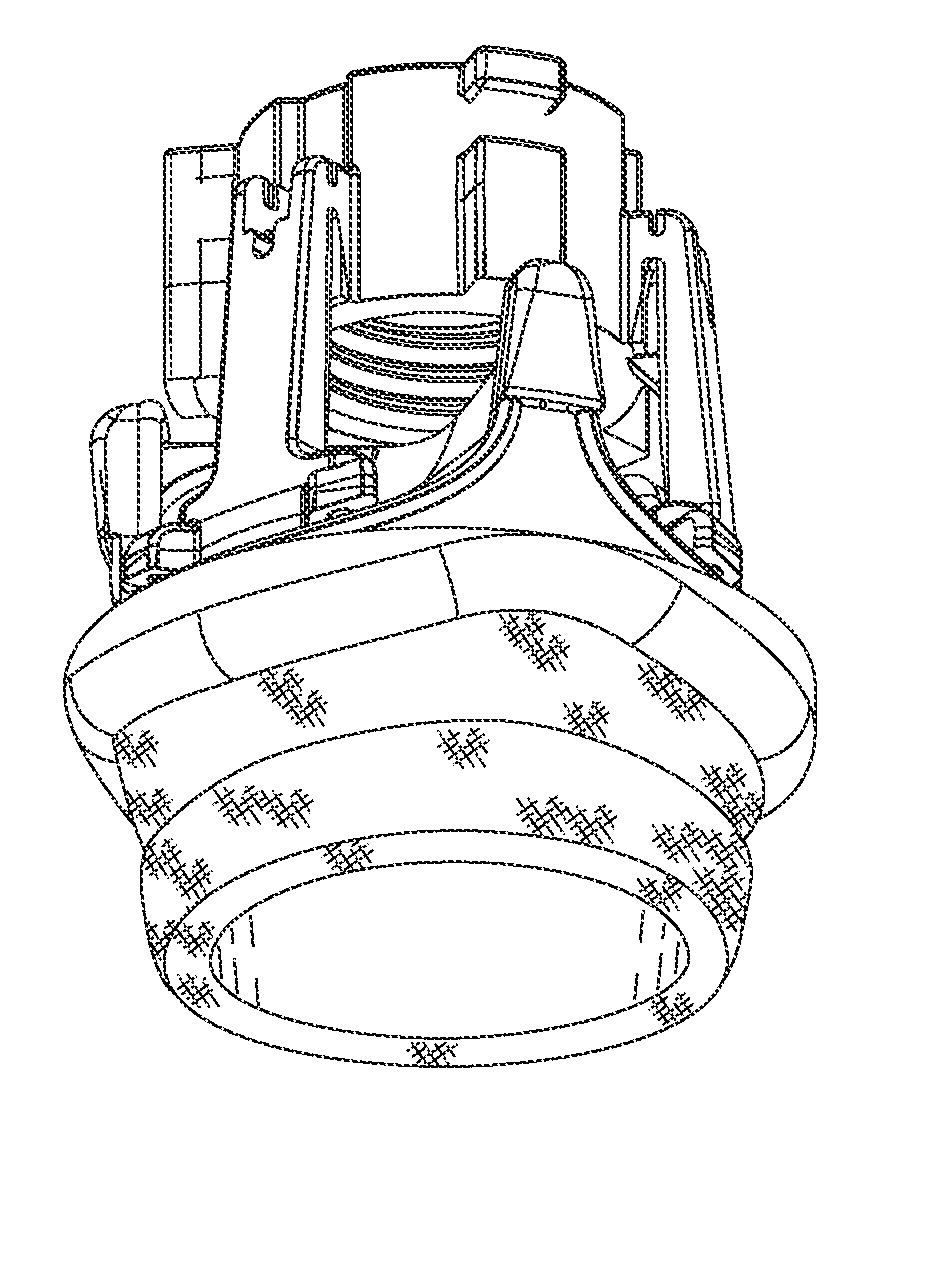 Rapidly deployable surgical heart valves