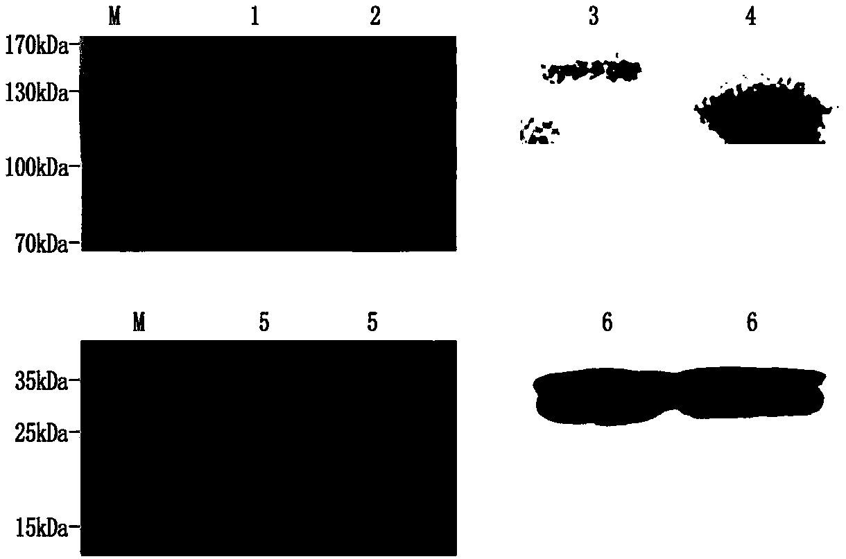 Porcine circovirus-mycoplasma pneumonia duplex subunit vaccine and preparation method thereof